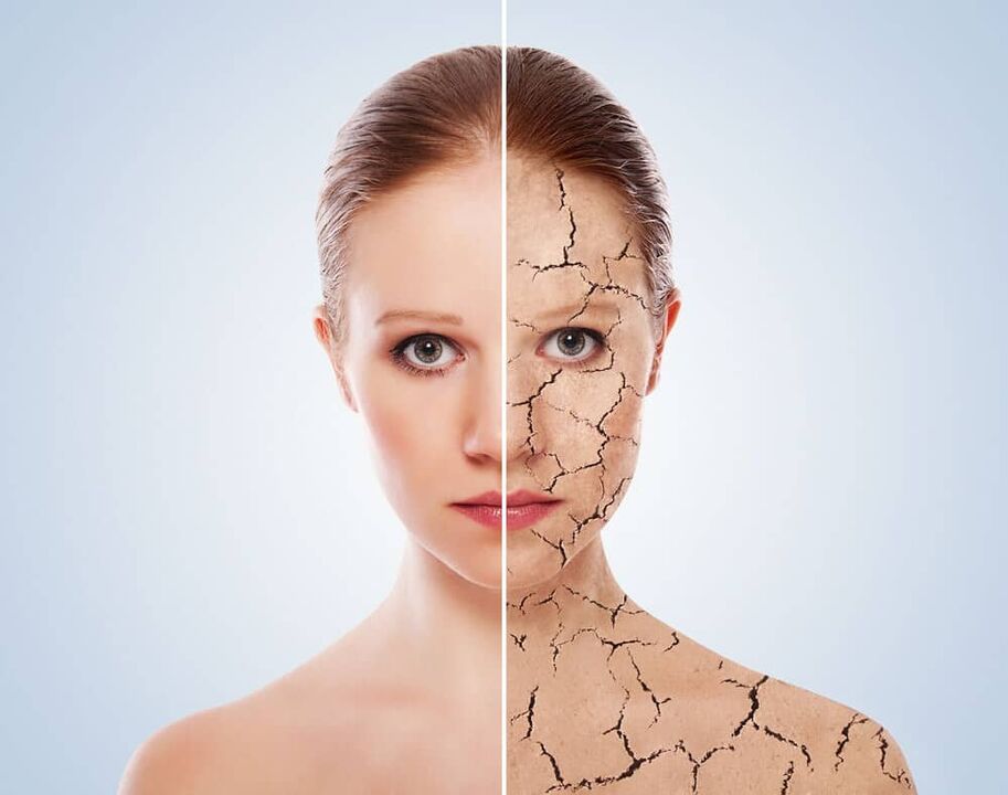 Pelle sana e pelle affetta da psoriasi